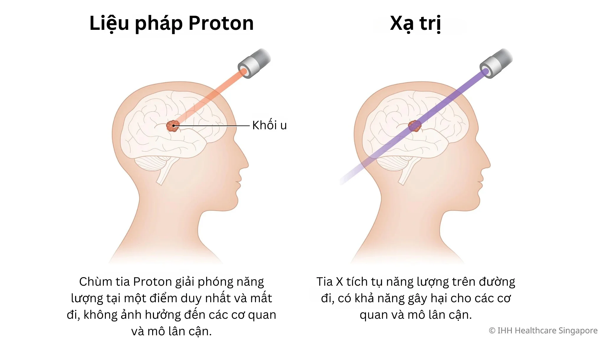 Câu hỏi thường gặp về mô phỏng xạ trị