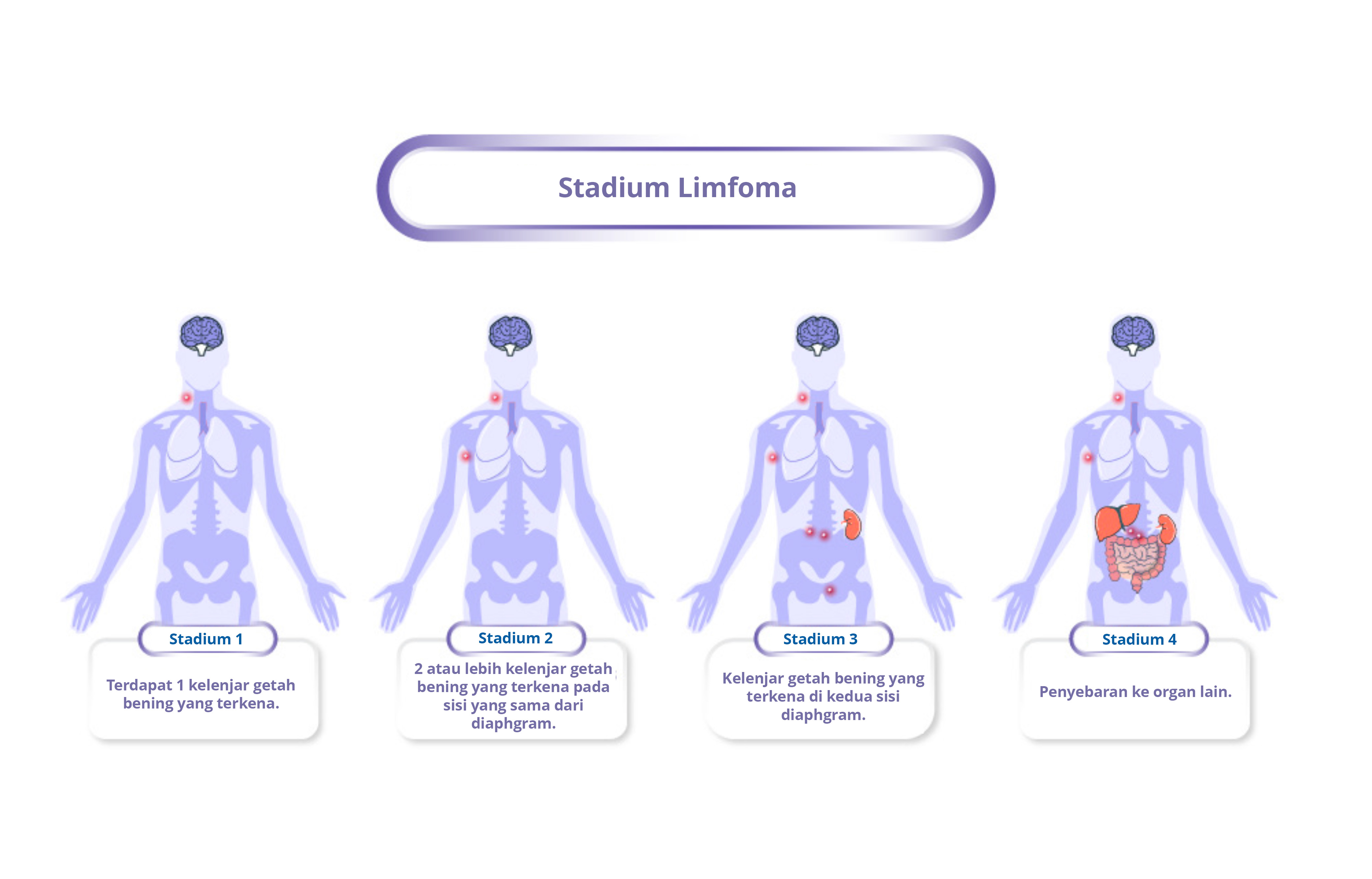 Staging of Lymphoma