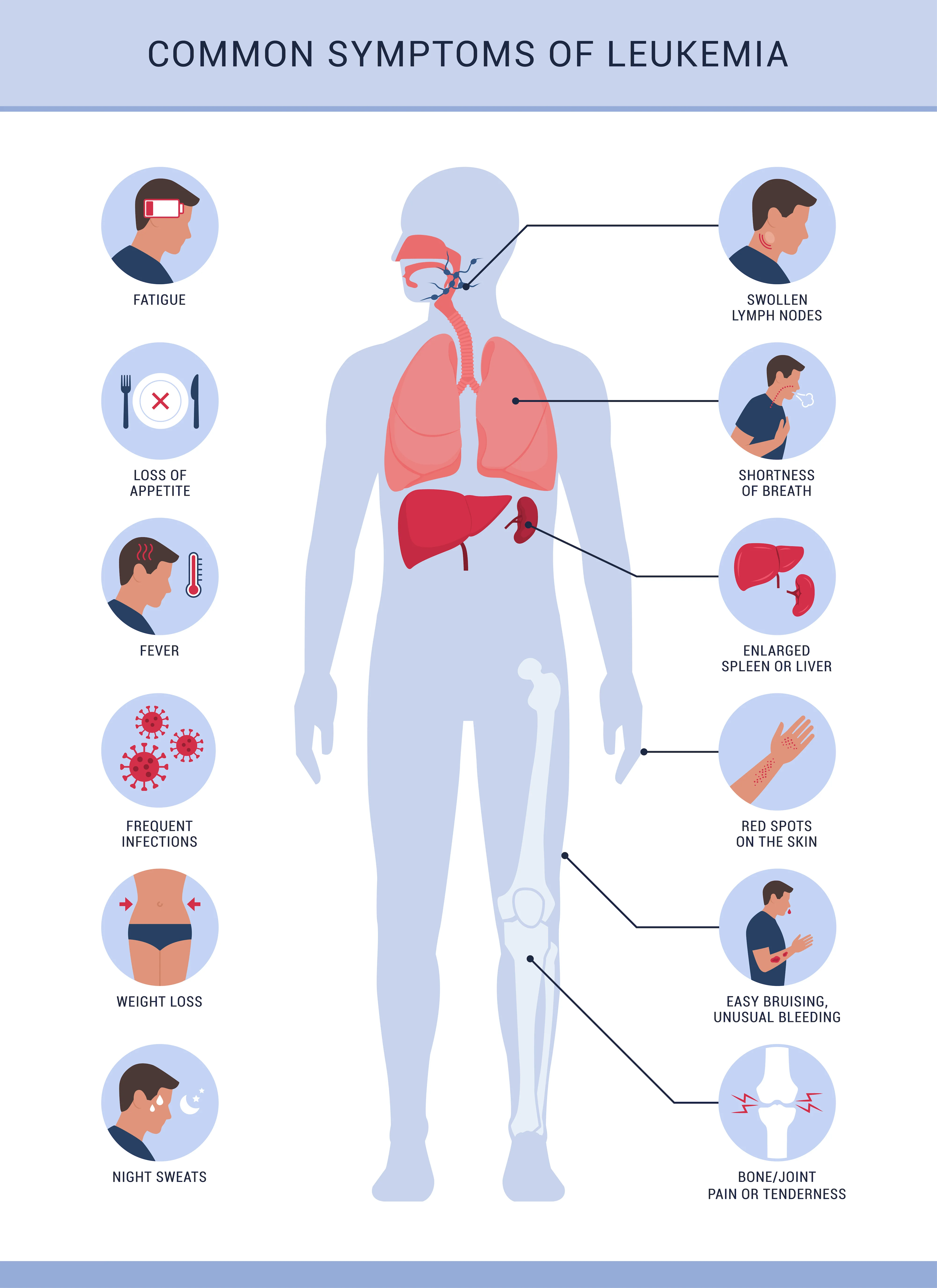 lymphoma infographic