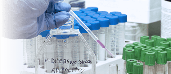 Haematopoietic Steam Cell Transplant