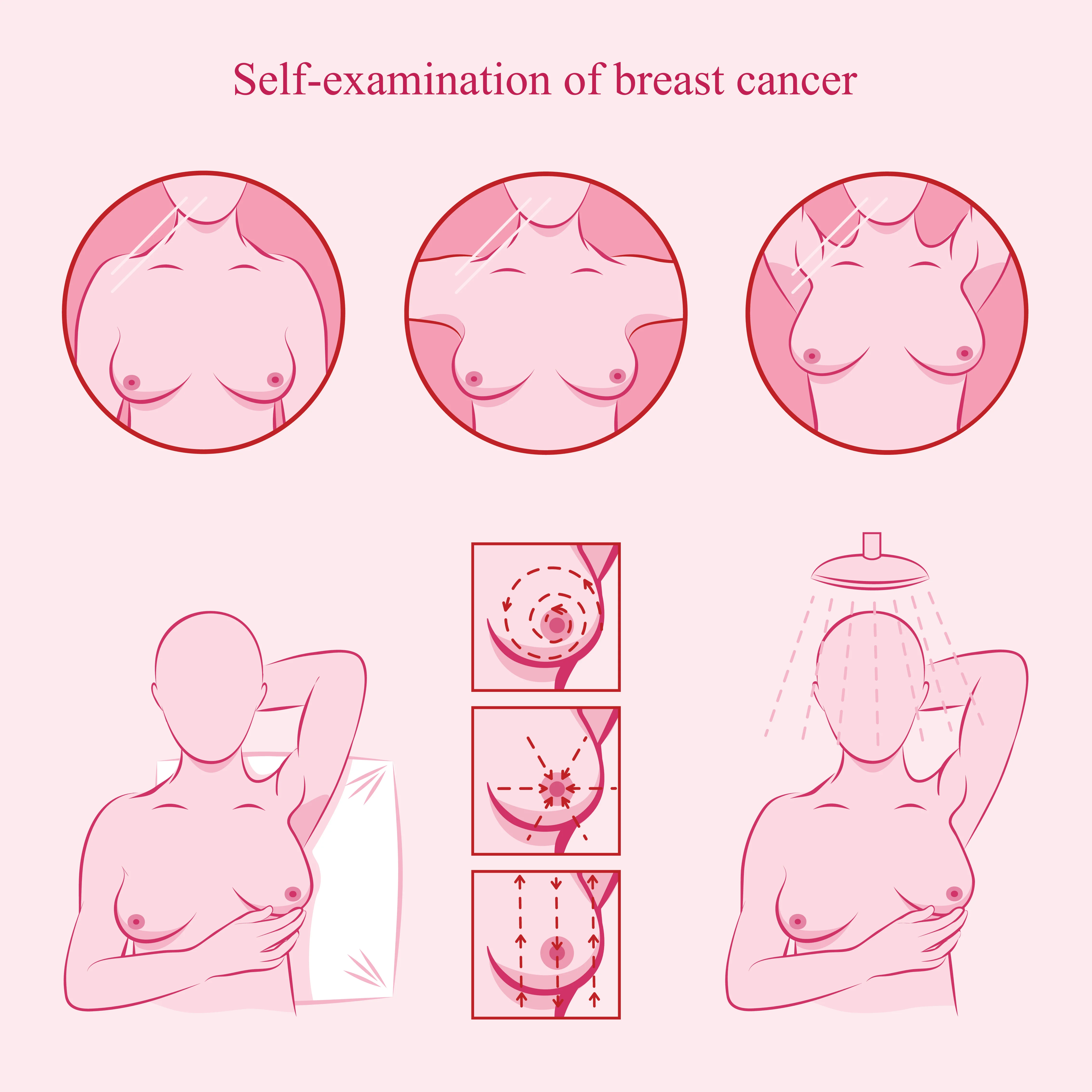 No babies, no boobs, no nipples: Coping with breast cancer under